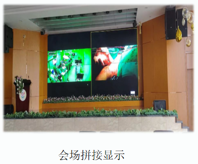 认识手术示教